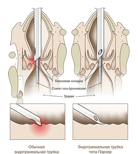 Мешок Амбу MEDEREN в кейсе-переноске