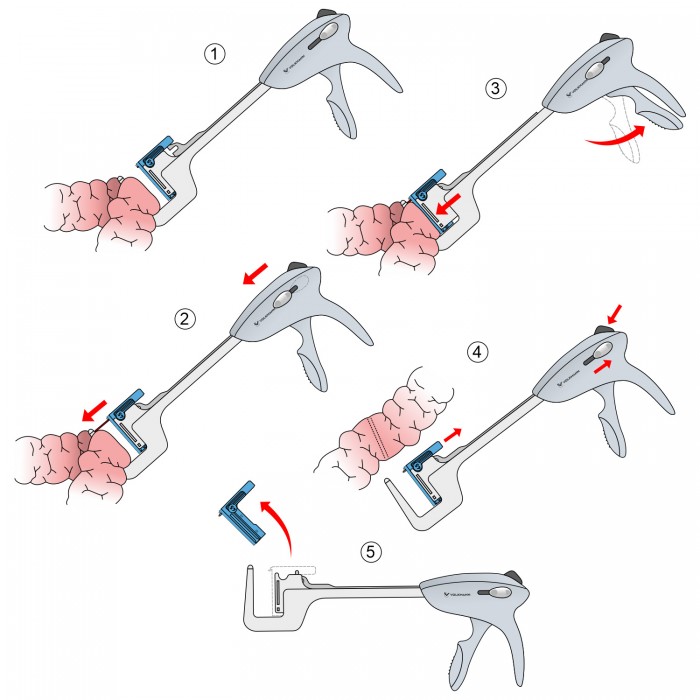 1) Расположите между браншами кассеты ткань, которую необходимо прошить.Удостоверьтесь, что ткань полностью помещена в кассету;
2) С помощью ползунка отведите металлический предохранитель к упорной бранше;
3) Сомкните бранши кассеты с помощью рукоятки прошивания. Повторное нажатие на рукоять совершит прошивание;
4) После совершенных манипуляций, нажмите на кнопку раскрытия браншей кассеты для отсоединения упорной бранши от кассеты;
5) В случае необходимости смены кассеты, потяните за ее боковую часть вверх, отсоединяя от сшивающего аппарата.