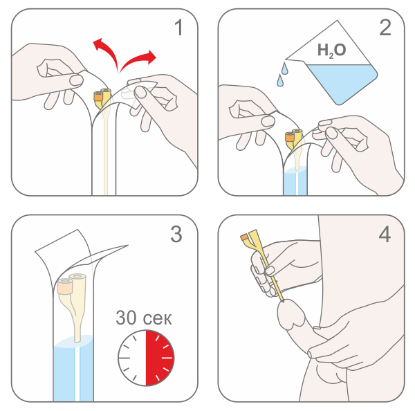 Схема работы с катетерами Фолея с гидрофильным покрытием