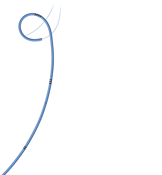 Стент мочеточниковый с ретракционной нитью