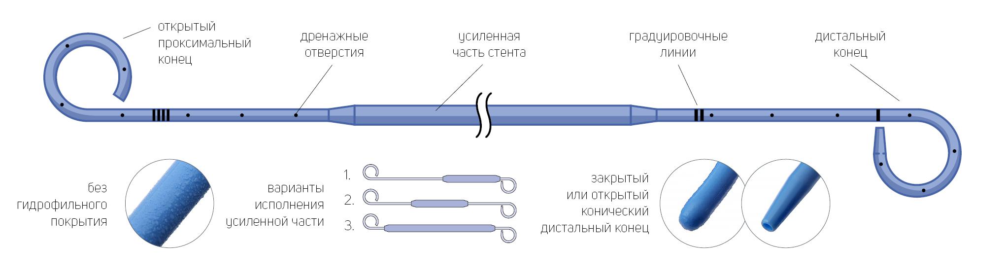 Стент мочеточниковый онкологический  двухпетлевой