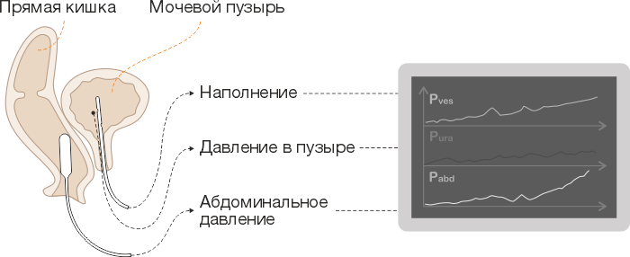 Схема проведения уродинамических исследованийи