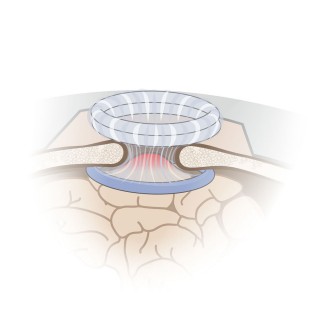 Совершите необходимые манипуляции в готовом операционном поле