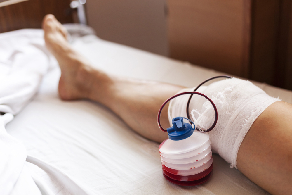 История дренирования постоперационных ран